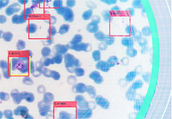 image processing graphic