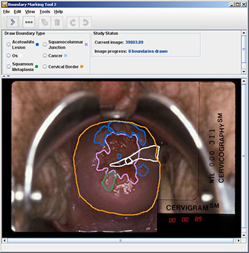 A screenshot Boundary Marking Tool (BMT).